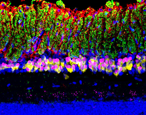 Xiaorong's lab has 3 papers in press