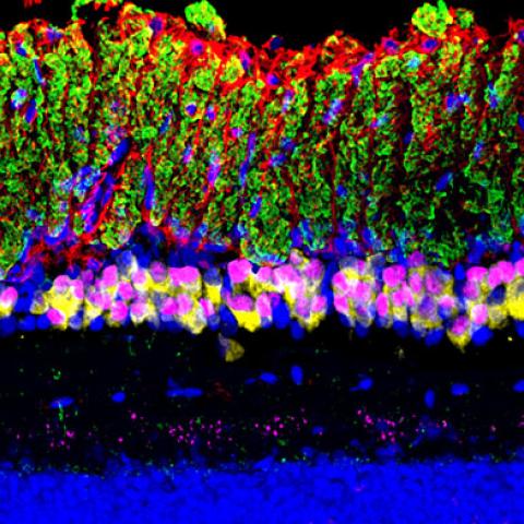 Xiaorong's lab has 3 papers in press